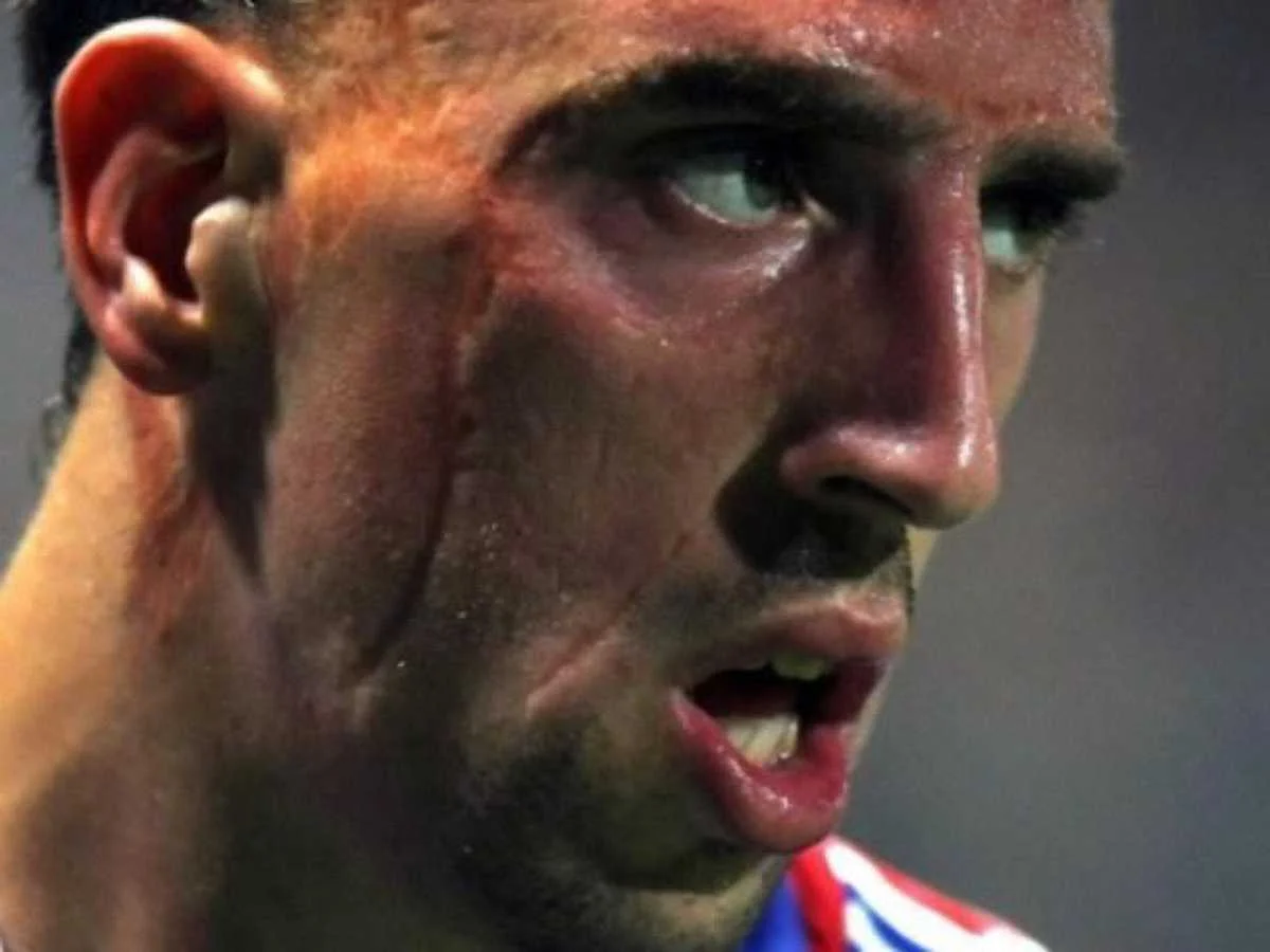 Франк Рібері - гроза для суперників