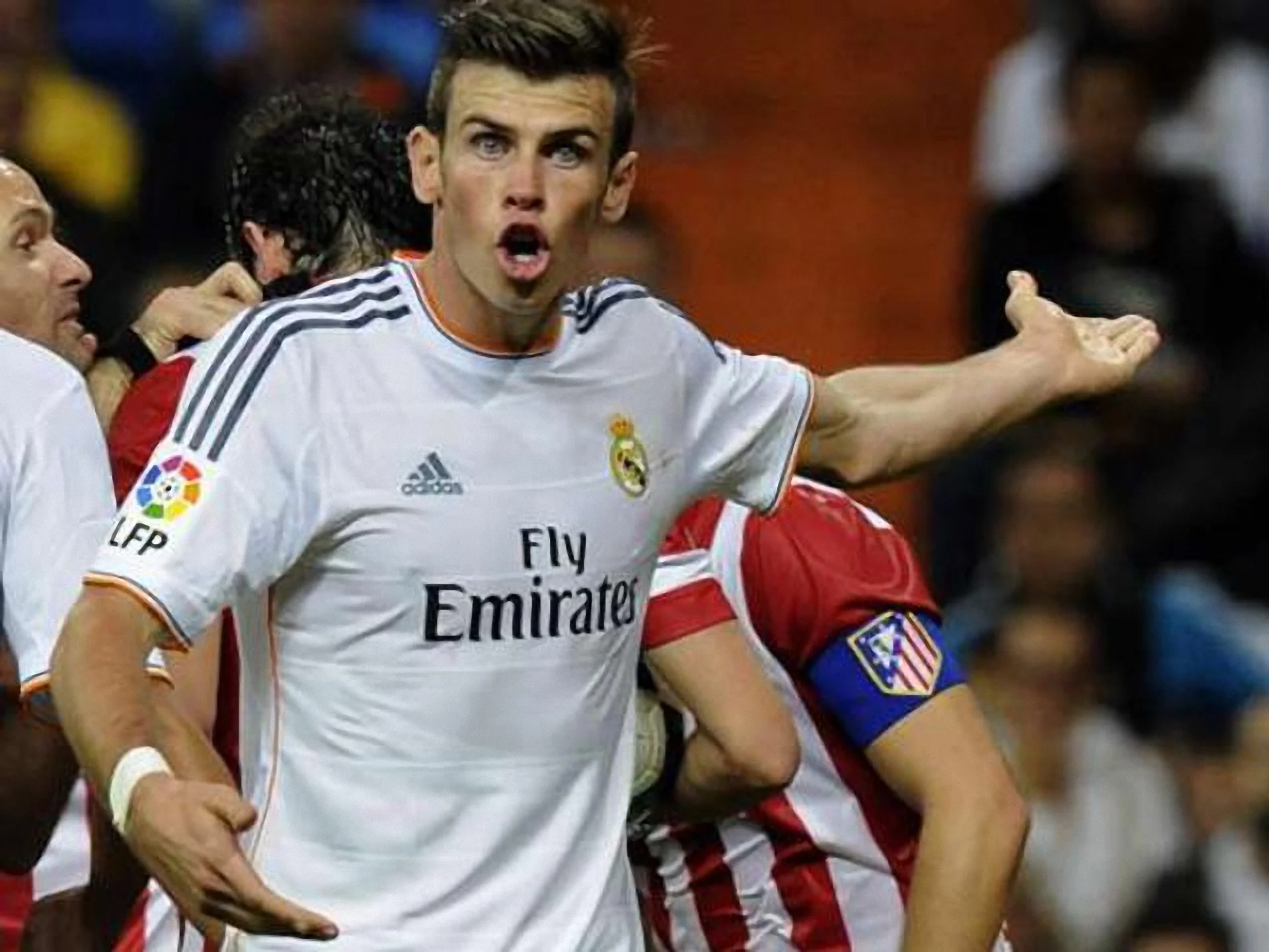 Про травму Бейла знали ще на презентації