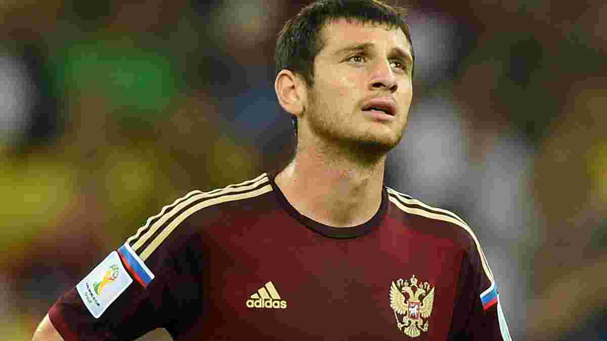 Лідер збірної Росії зламав ногу і не зіграє на Євро-2016