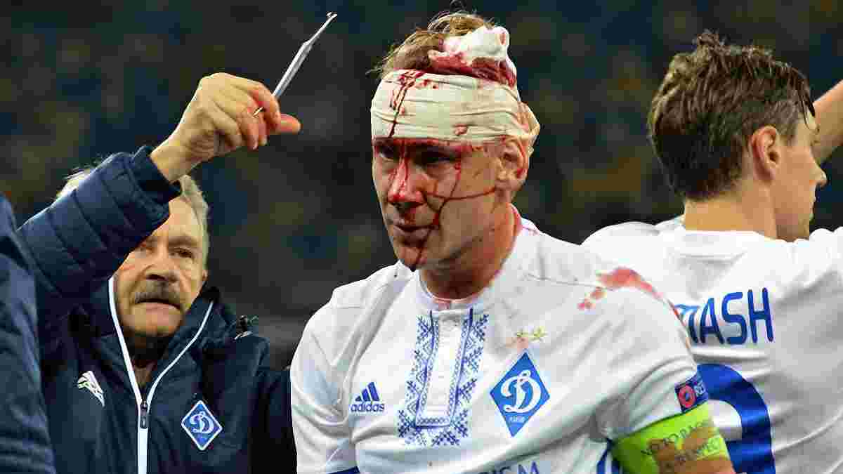 Динамо – Янг Бойз: фото кривавої травми Віди