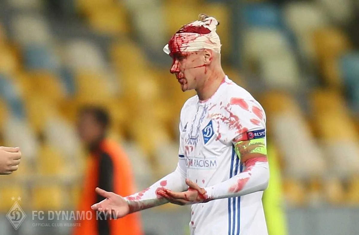 Домагой Вида получил тяжелую травму / ФК Динамо