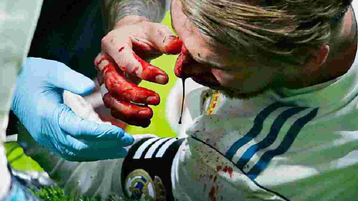 Рамос: Я готов тысячу раз истечь кровью за футболку Реала