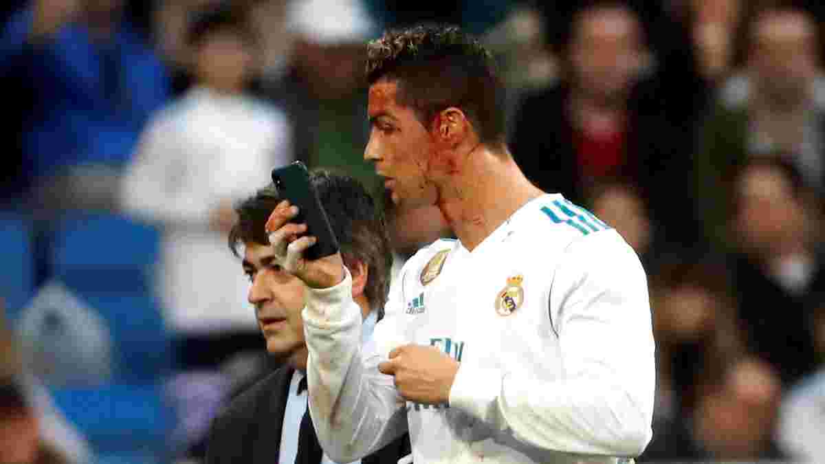 Роналду разбили лицо, когда он забивал гол в ворота Депортиво – Криштиану был разочарован своим видом