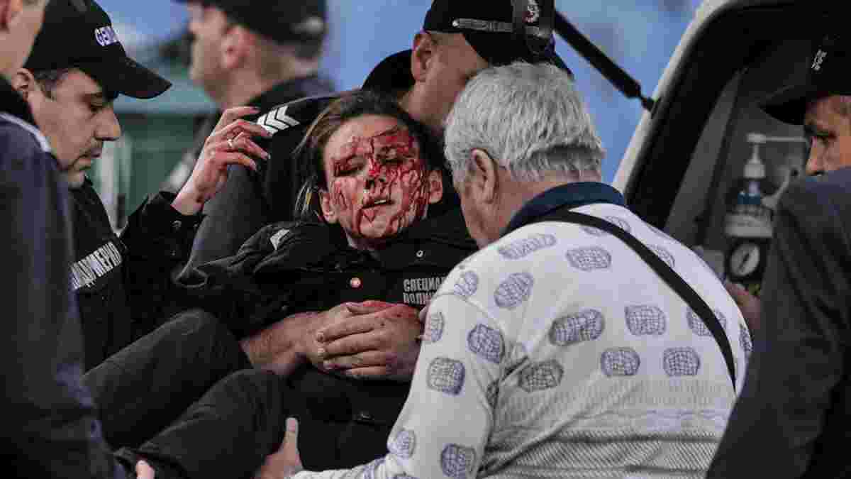 У Болгарії під час матчу ЦСКА – Левскі постраждала жінка-поліцейський