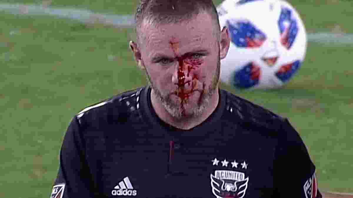 Руни разбили голову в кровь во время матча МЛС