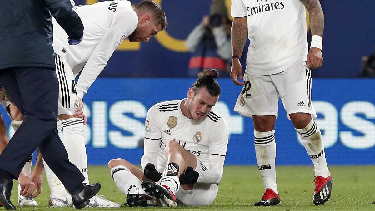 Травмированный Бейл / Marca