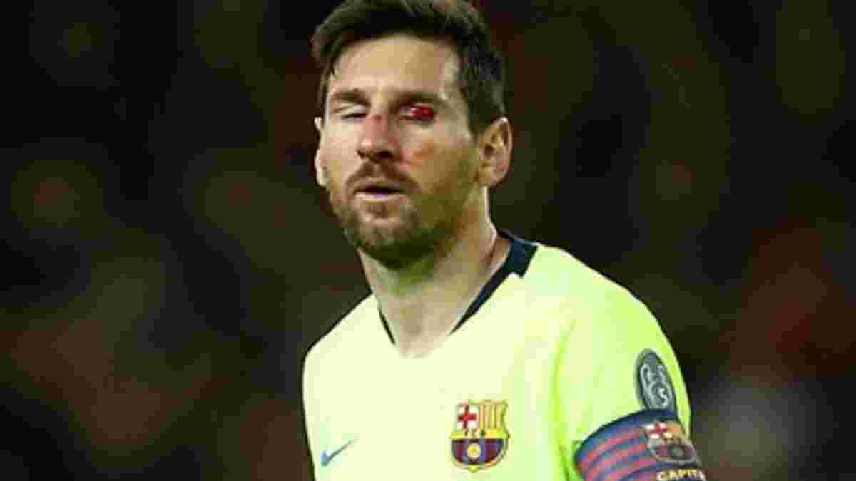 Манчестер Юнайтед – Барселона: Смоллінг розбив Мессі обличчя – криваві фото
