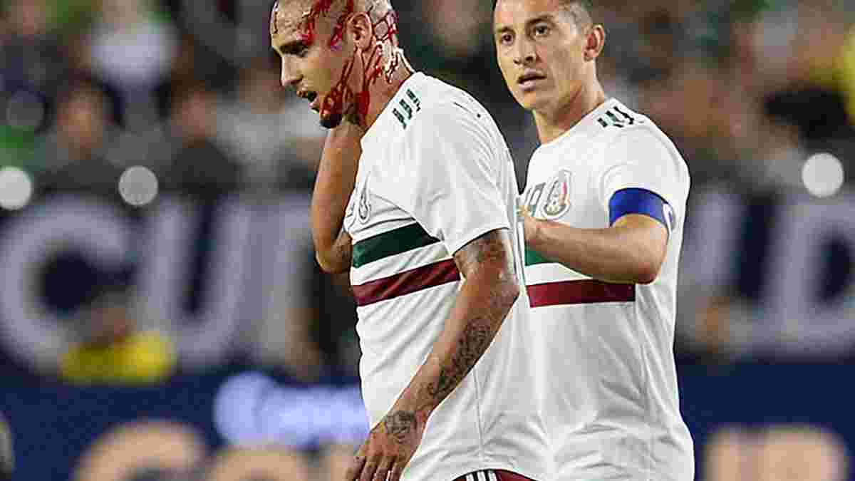Золотий кубок КОНКАКАФ-2019: мексиканець Луїс Родрігес зазнав моторошного пошкодження, отримавши коліном у потилицю