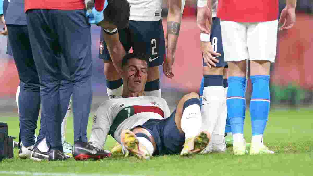 Роналду разбили нос в матче Лиги наций против Чехии: кровавые кадры