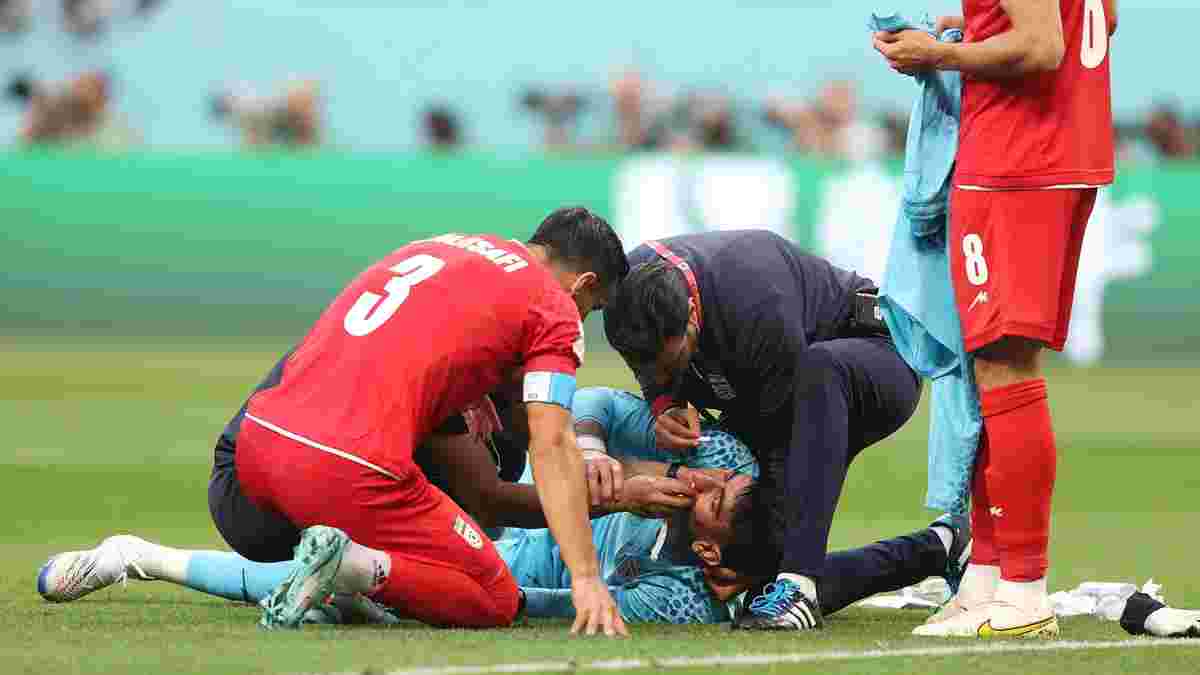 Перша кров на чемпіонаті світу – голкіпер Ірану розчавив обличчя у зіткненні з партнером