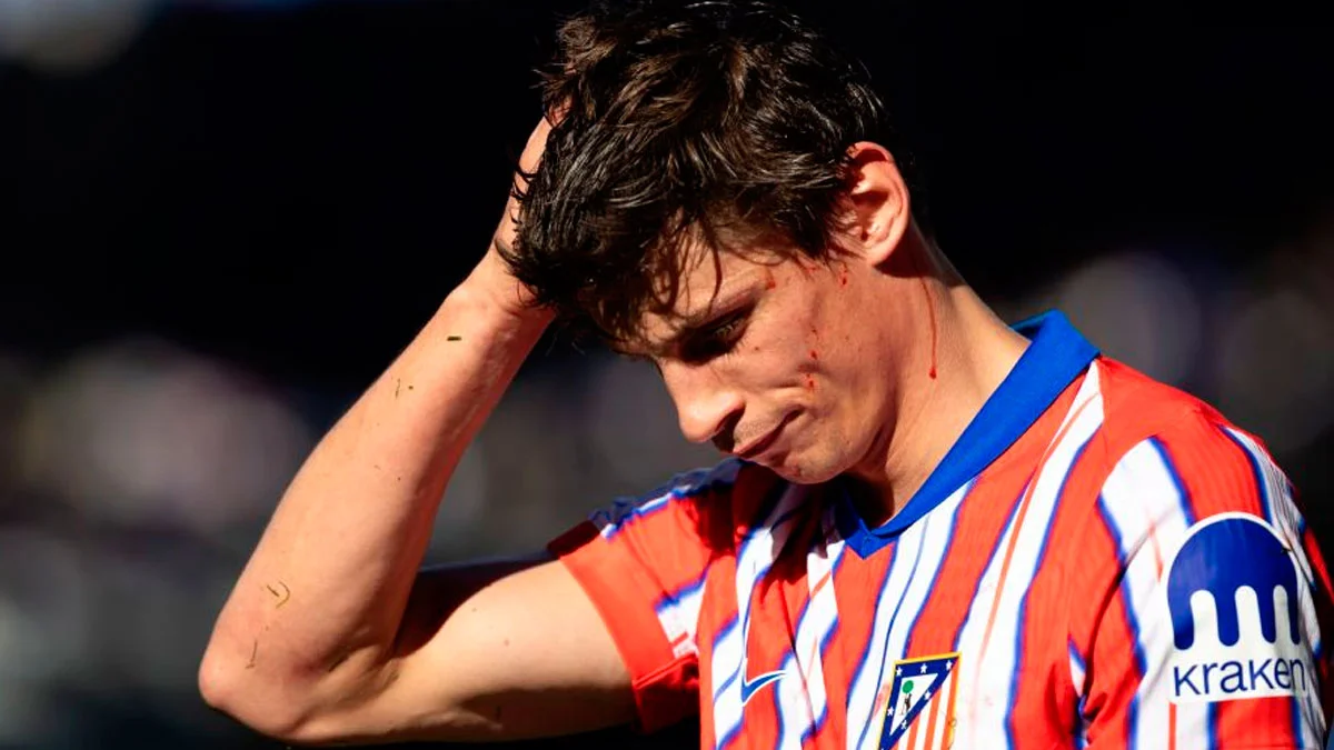 Ле Норману в матчі з Еспаньйолом розбили голову / LaLiga