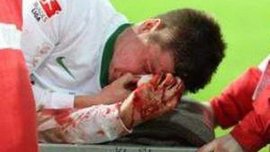 Куема извинился перед Прьодлем за сломанную челюсть. ВИДЕО Куема извинился перед Прьодлем за сломанную челюсть. ВИДЕО