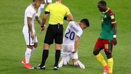 Камерун – Чилі: Сіані одним помахом бутса зняв шорти з Арангіса Камерун – Чилі: Сіані одним помахом бутса зняв шорти з Арангіса